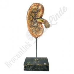 Unieke oude vintage Anatomisch model nier No.2