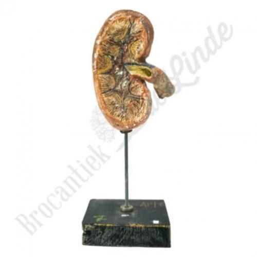 Unieke oude vintage Anatomisch model nier No.2