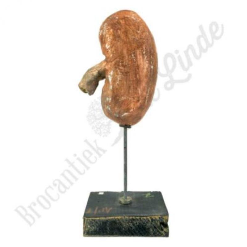 Unieke oude vintage Anatomisch model nier No.2